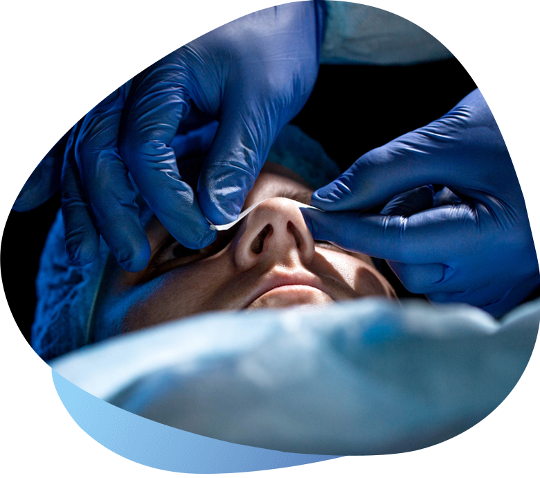 Endoskopowe operacje przegrody nosa shape