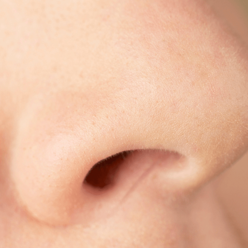 Operacje malzowin nosowych