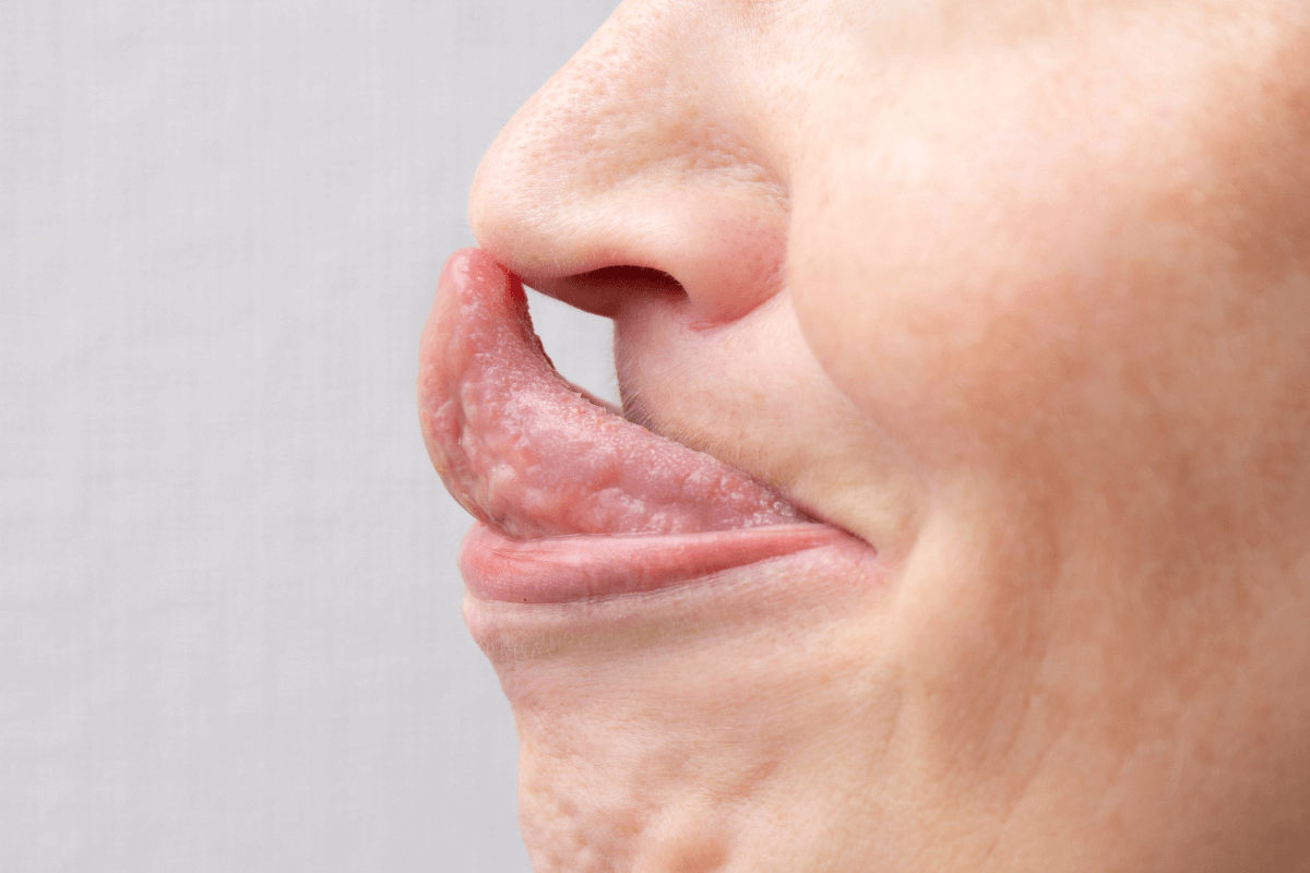 Wystaw jezyk i sproobuj dotknac jego koncem czubek nosa